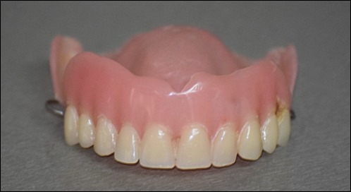 잇몸이 붓는 이유 7