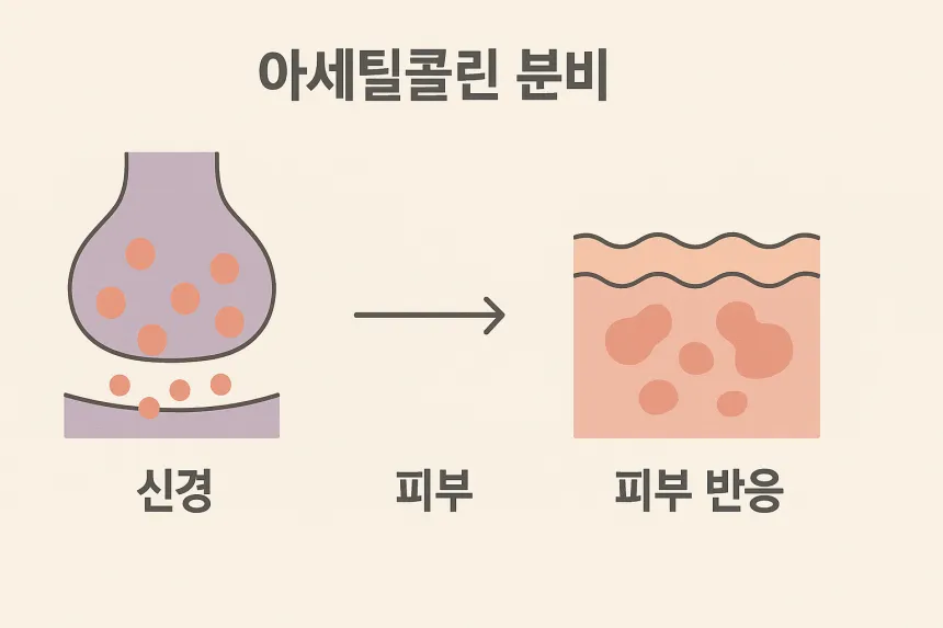 콜린성 두드러기