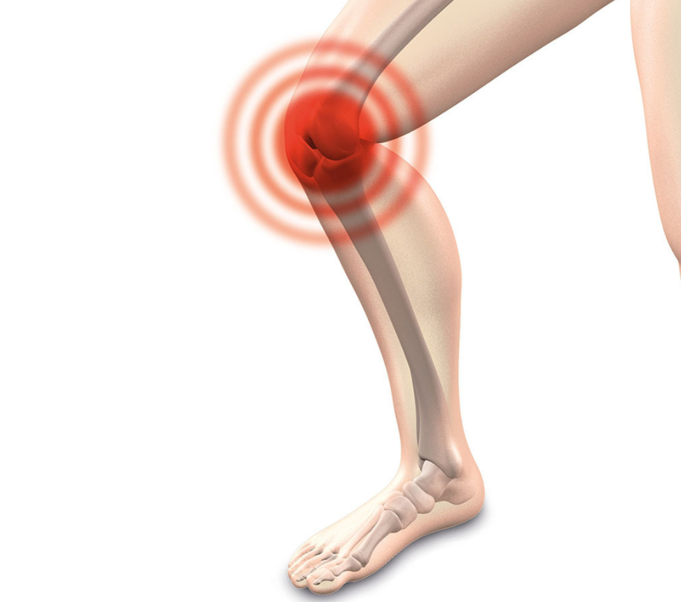 무릎 뒤쪽 통증