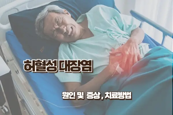 허혈성 대장염의 원인과 증상&#44; 치료 방법