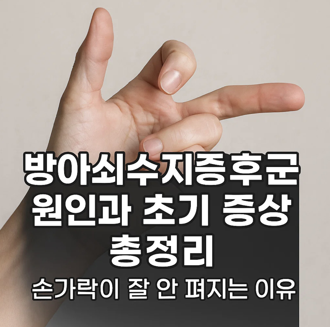방아쇠수지증후군 원인과 초기 증상 총정리, 손가락이 잘 안 펴지는 이유