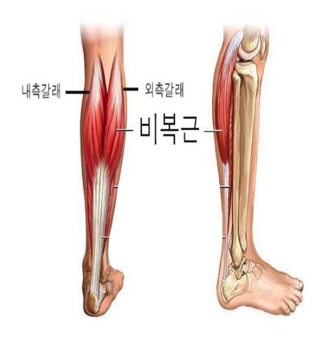 비복근-위치-설명도