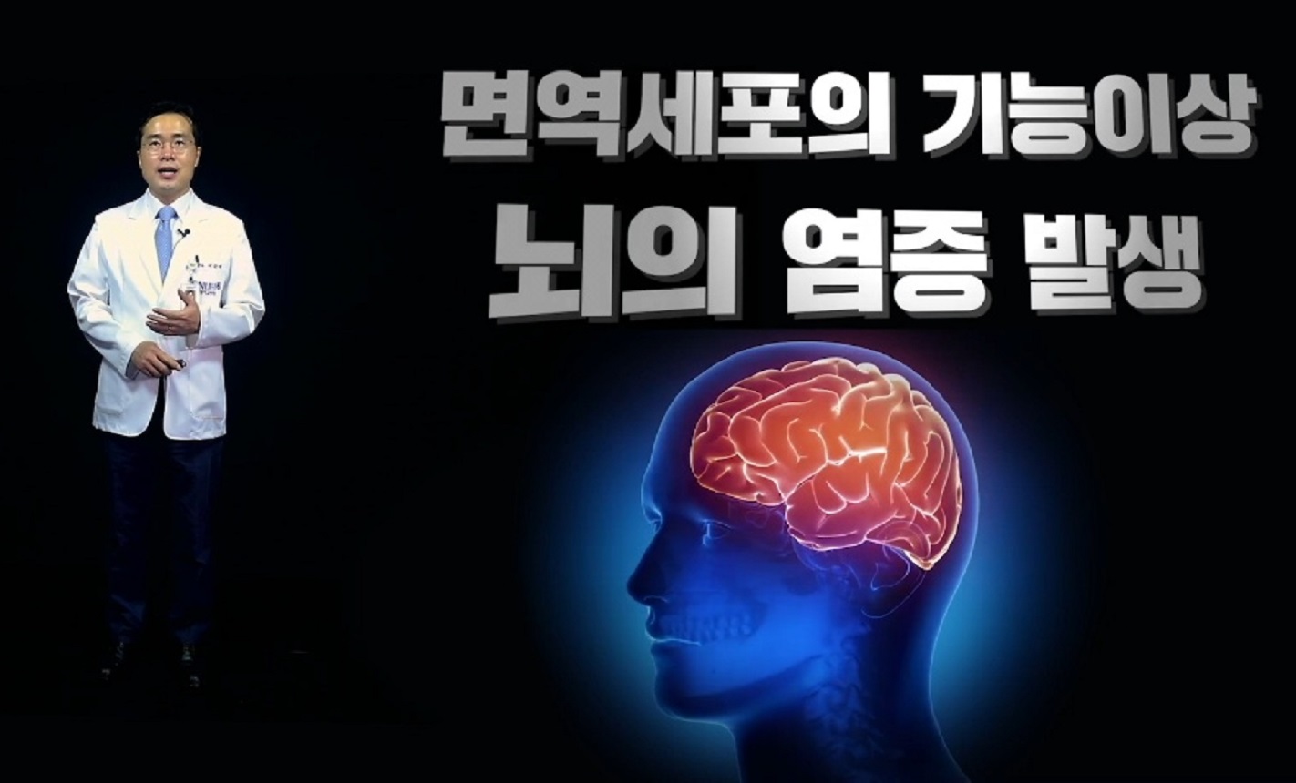 EBS-명의-이순태-교수-자가면역-뇌염-신경과