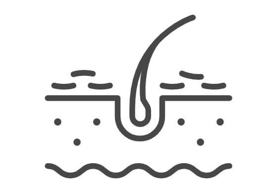 두피의 모낭을 그린 이미지