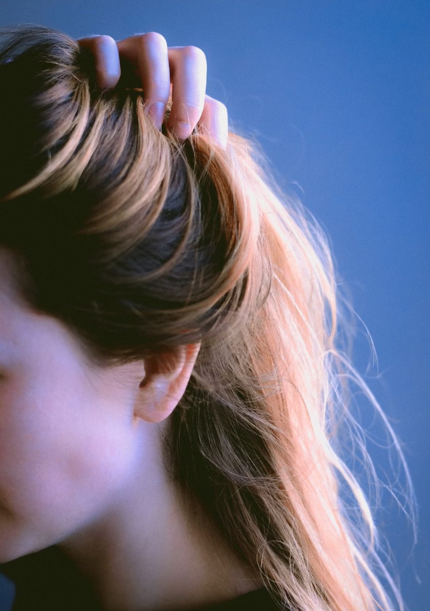 여성 탈모 원인