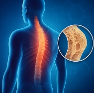 골다공증에 좋은 음식