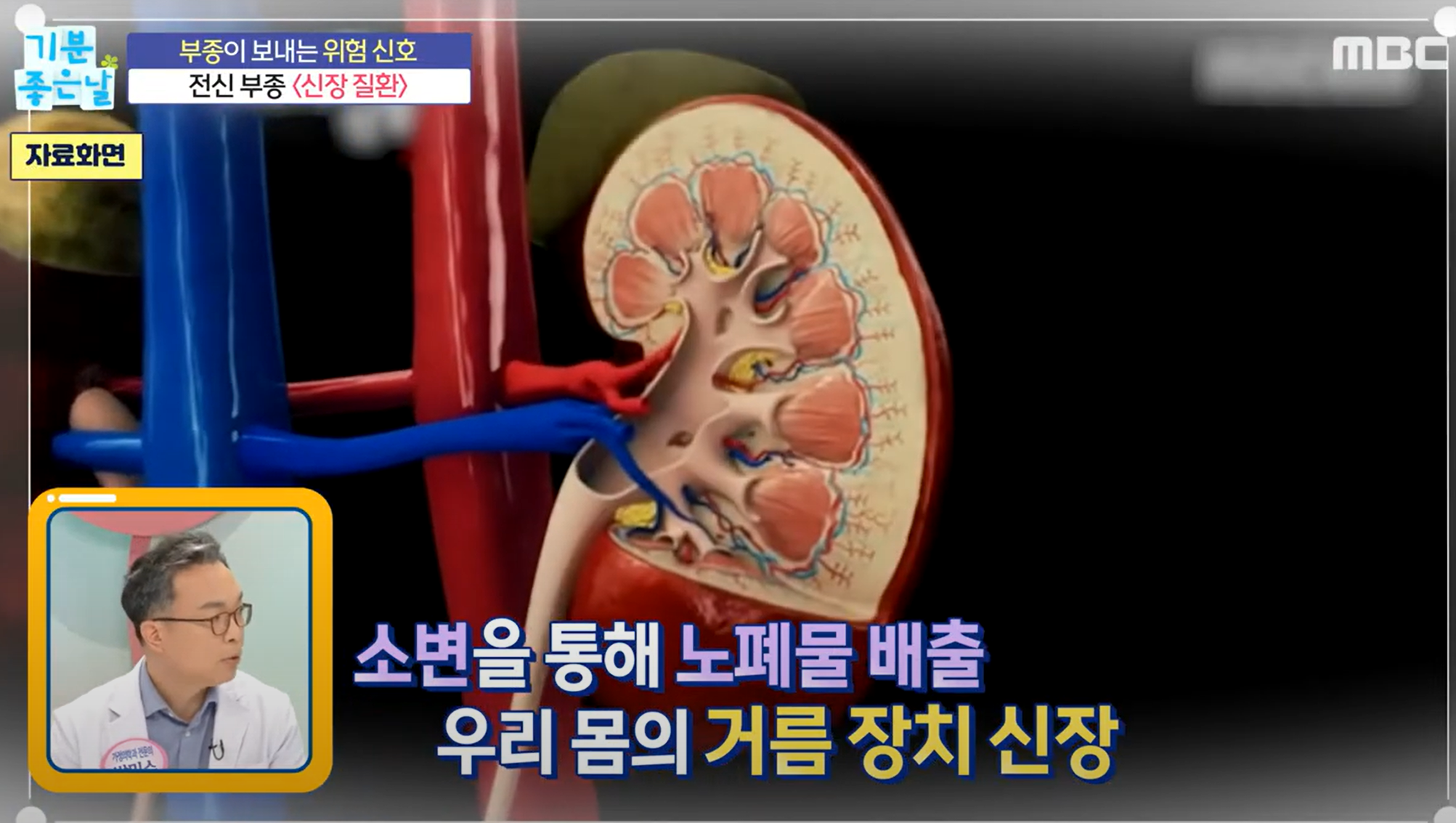 신장 질환
