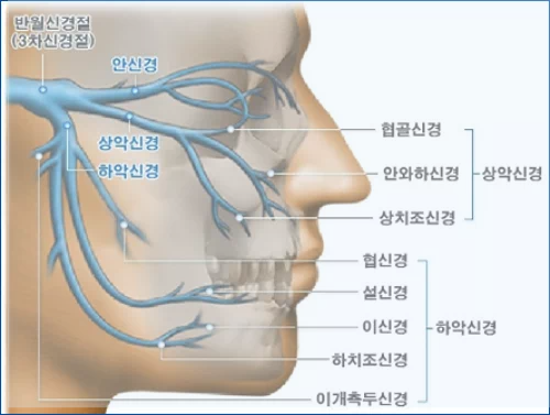 3차신경