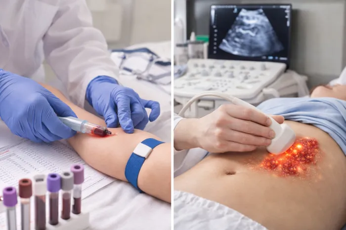 간수치가 높으면 나타나는 증상