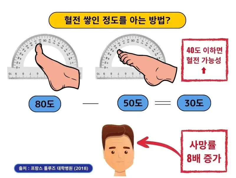 혈전용해제 나토키나제