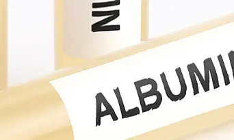 알부민 종류