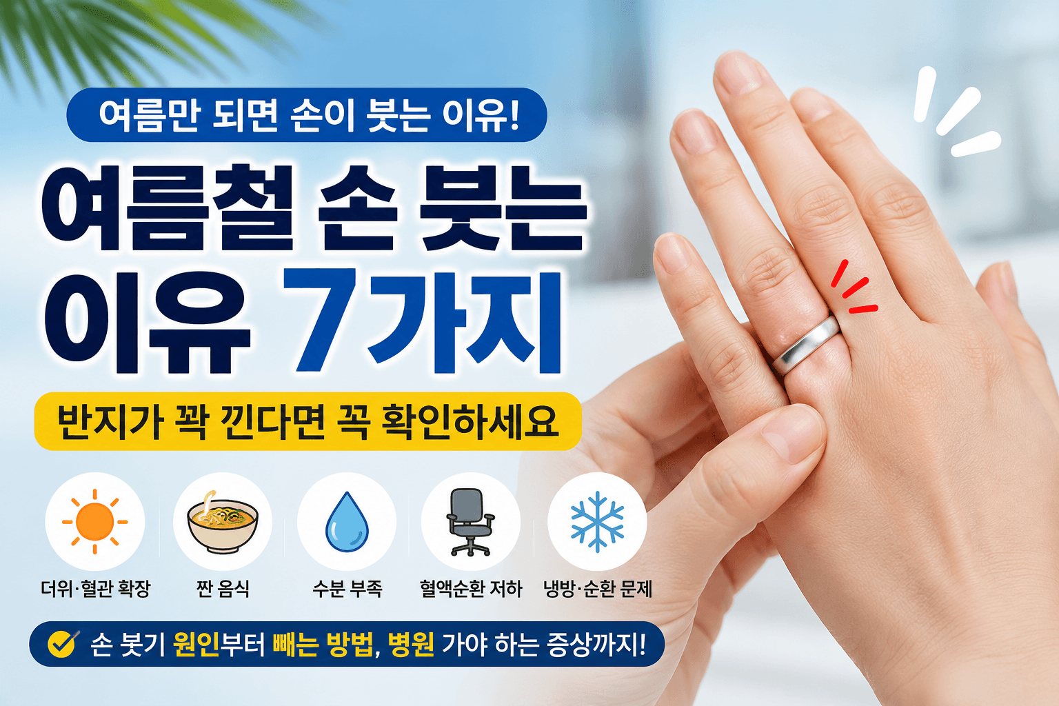 여름철 손 붓는 이유 7가지, 반지가 꽉 낀다면 꼭 확인하세요