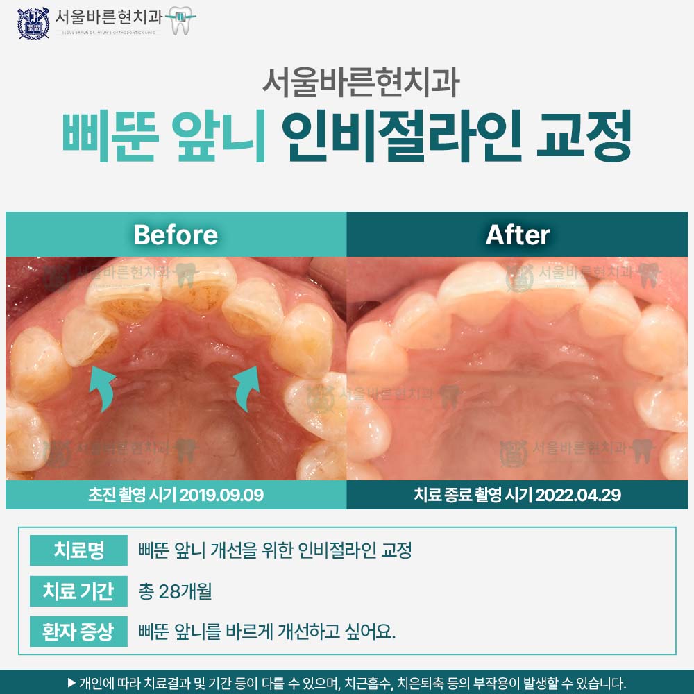 해운대인비절라인