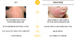 아토피 식단