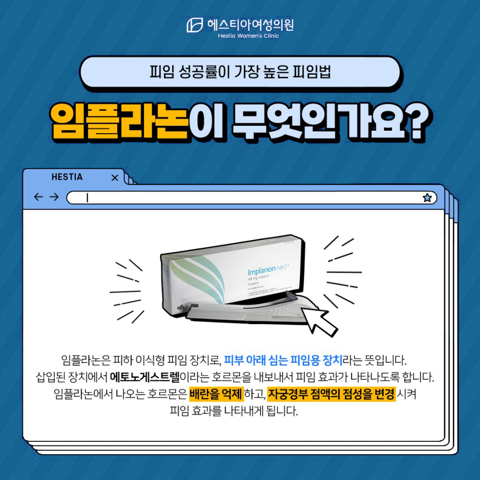 임플라논이 무엇인가요?