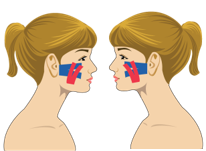 턱관절 통증 완화를 위한 테이핑