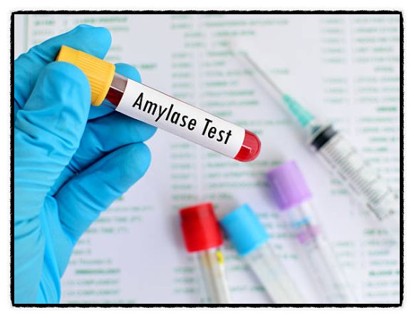 아밀라제 수치가 높은 이유