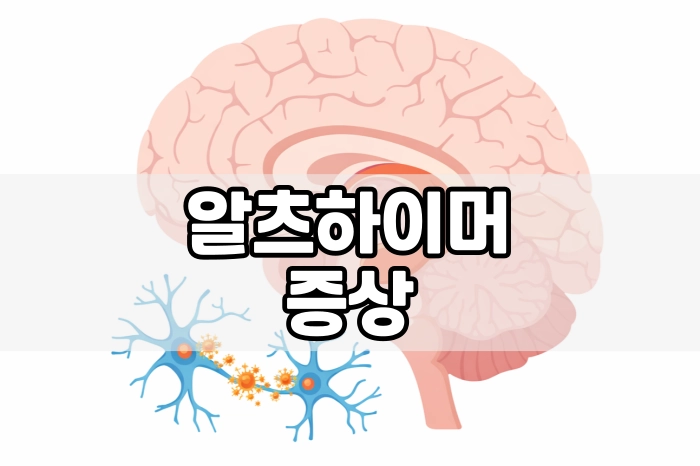 알츠하이머 초기증상