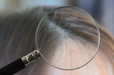 흰머리 방지 방법