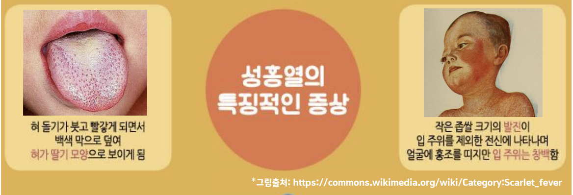 성홍열 증상 검사 전염 격리기간 총정리