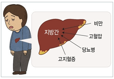 지방간, 고혈압, 고지혈증