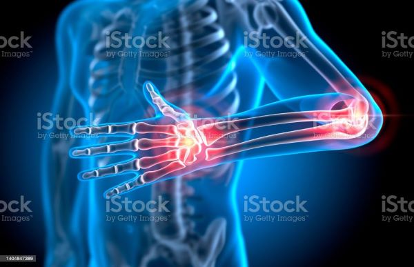 팔꿈치엑스레이