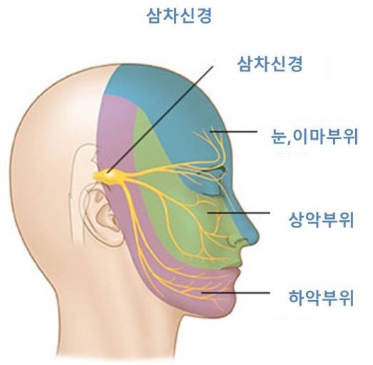 삼차신경병증