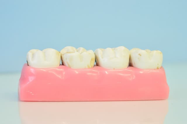 어금니 잇몸 부었을때