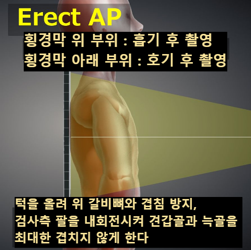 선자세 AP