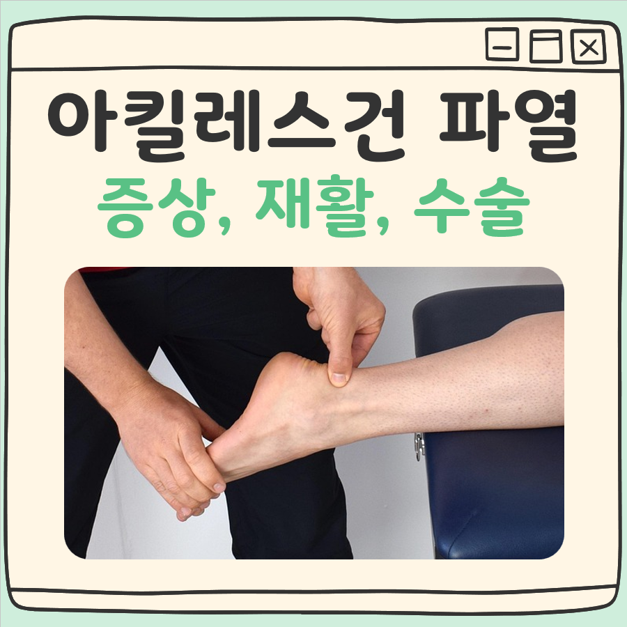 아킬레스건 파열 증상과 재활, 수술 여부를 고민하는 분들께