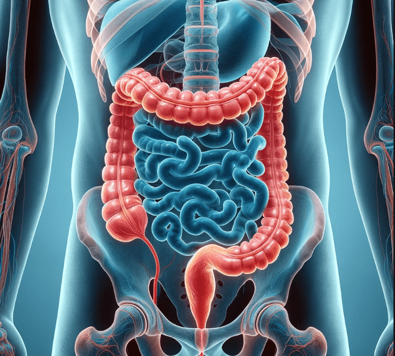 맹장염 초기증상
