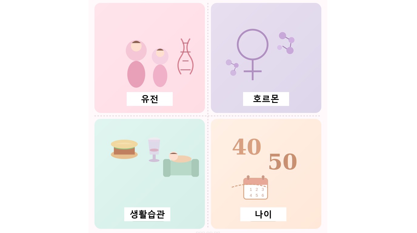 유방암 원인 4분할 일러스트: 유전, 호르몬, 생활습관, 나이