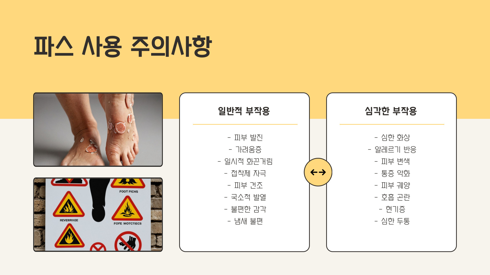 발바닥 파스 붙이는 방법