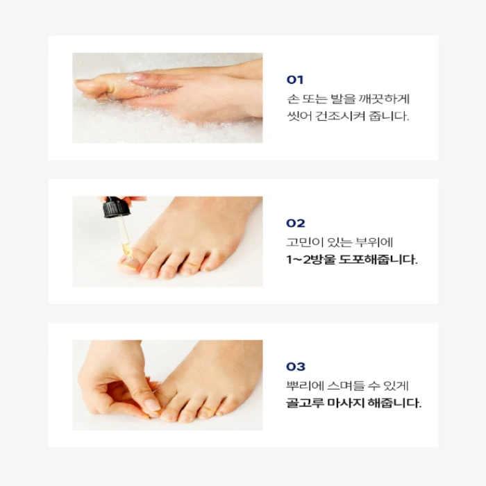 셀라큐어 문제성 발톱 솔루션 내돈내산 후기 부작용 성분 효능 사용법 가격 