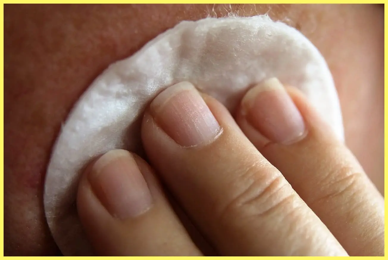 햇빛알레르기 예방과 완화에 좋은 생활습관 5가지 – 여름철 피부 보호 루틴