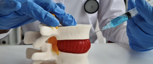 추간판 탈출증 수술 과정