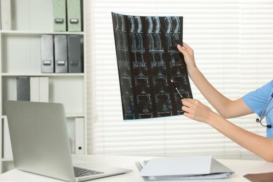 경추 디스크의 약물치료: 효과와 사용 방법