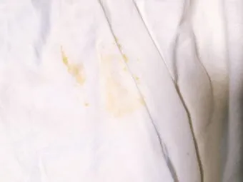 흰옷 얼룩 과탄산소다 불림과 햇빛 건조 누렇게 방지_5
