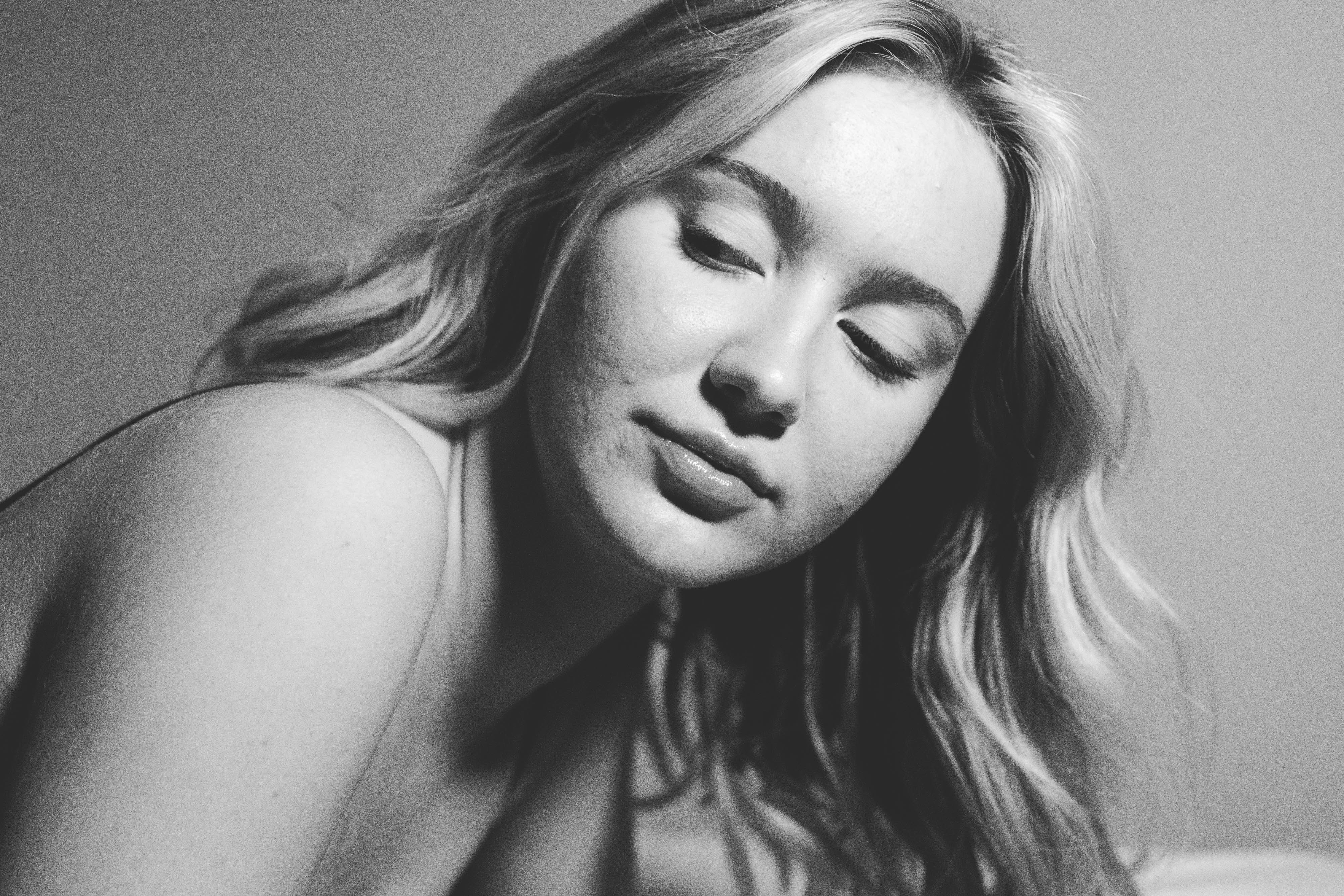 점 빼는 비용 점 빼고나서 관리법