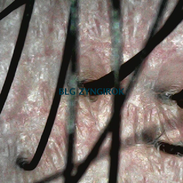 피나모아 복용 13주차 두피 사진 - 뒷머리 비교군 모습이다.