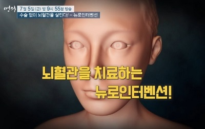 뇌혈관치료-뉴로인터벤션
