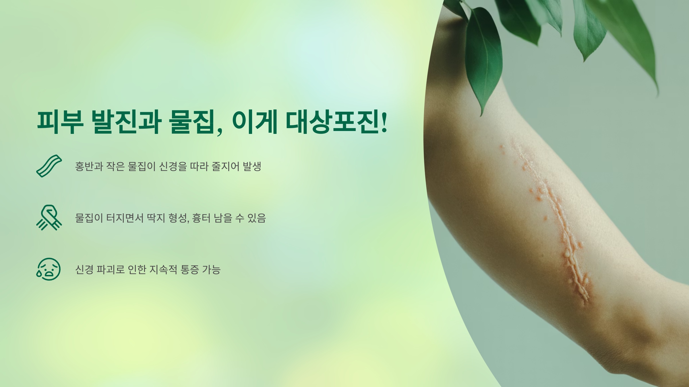 대상포진이 더 심해지기 전에: 피부 발진과 물집