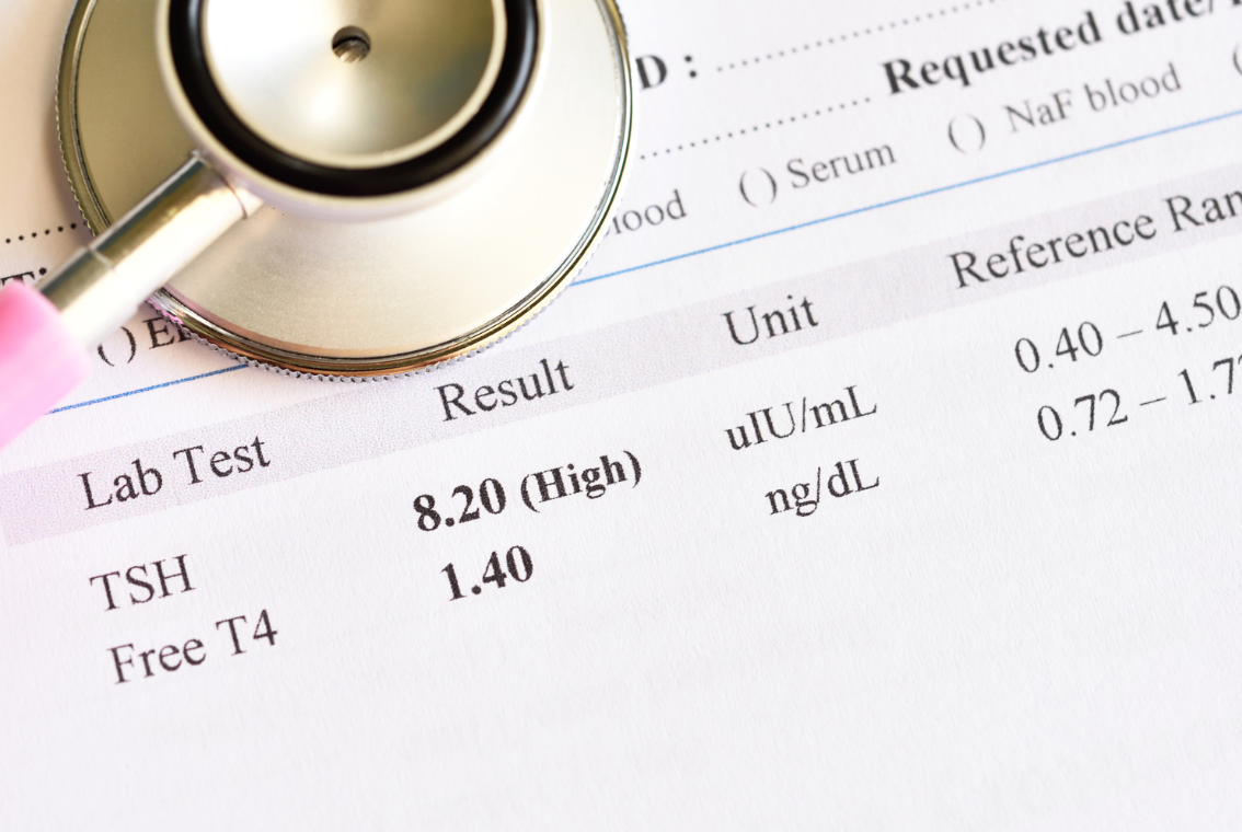 초음파를 통해 결절과 표면의 상태를 확인한다.