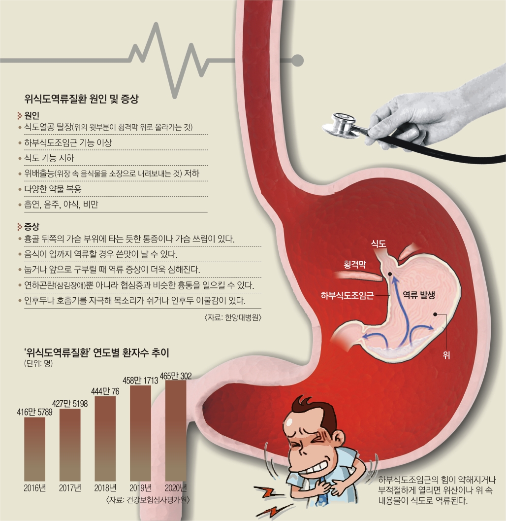 역류성 식도염 가슴 통증&amp;#44; 심장 문제와 헷갈리는 이유