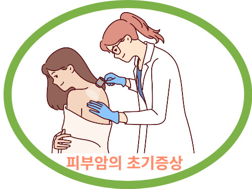 피부암의-초기증상