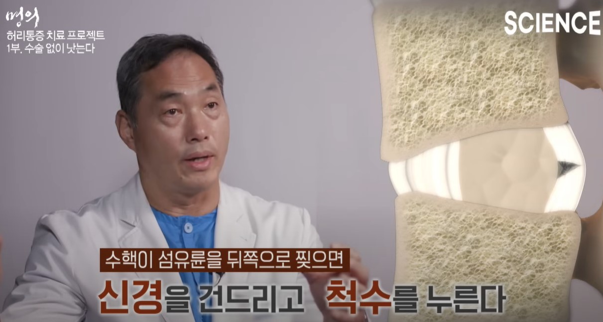 허리통증 설명하는 정선근 교수