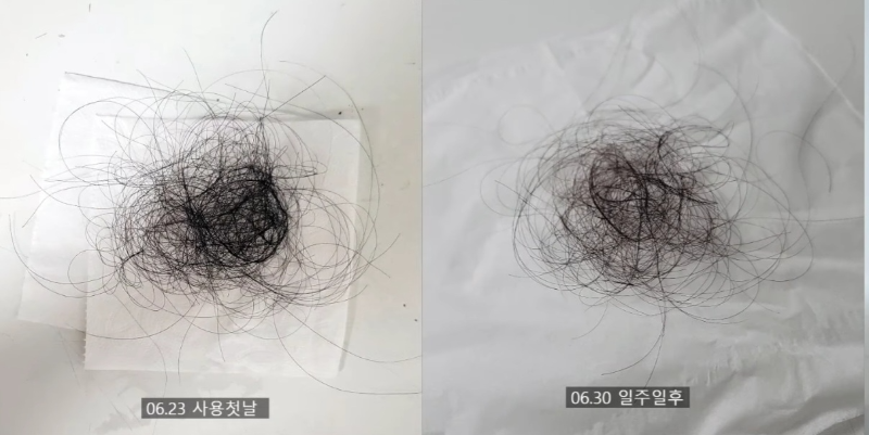 아침마다 베개에 쌓인 머리카락을 보고 한숨 쉬고 계시진 않나요?머리 감을 때마다 한 움큼씩 빠지는 머리카락을 보며 불안, 정수리 볼륨이 점점 꺼지는 것 같아 거울을 볼 때마다 스트레스