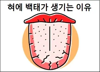 혀에 백태가 생기는 이유