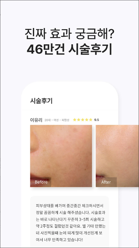 여신티켓, 피부과 정보, 피부과 전문의 모바일 상담 서비스
