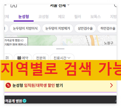 눈밑 지방재배치